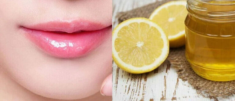 Môi thâm bẩm sinh có hết không? Cách trị môi thâm bẩm sinh 6 cach tri tham moi bam sinh 6 66792e9984f6a 768x432 1 e1758009456816