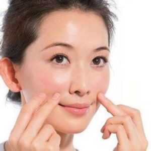 xóa nếp nhăn rãnh cười