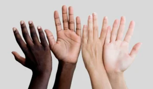 Tăng sắc tố da ở tay