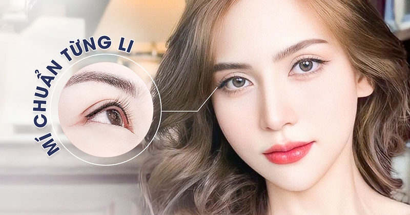 Cắt mí Ấn Độ 5 cat mi an do 7 1 e1758683234742