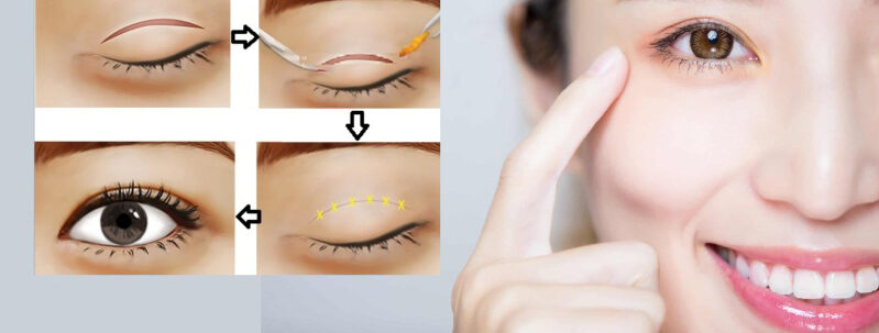 cat mi bao lau thi dep 1 e1758634126718