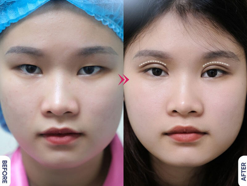 cat mi bao lau thi dep 9 e1758634403556