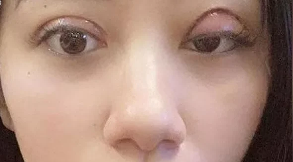 cat mi bi hong 1 e1758688941253