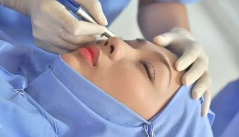 cat mi bi hong 2 e1758688992234