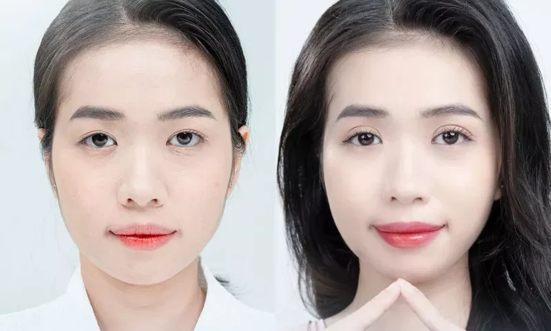 Mắt tứ bạch là gì? Ý nghĩa về tướng số của tứ bạch nhãn 9 cat mi mat han quoc 8 e1758705146258