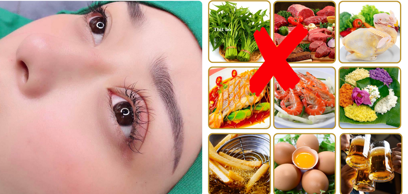 Nhấn mí kiêng ăn gì? Kiêng trong bao lâu? 1 Nhấn mí kiêng ăn gì? Kiêng trong bao lâu?