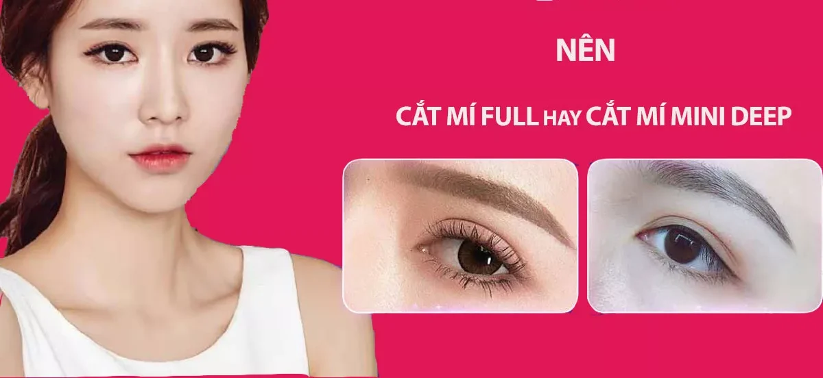 Cắt mí mini deep là gì? Có nên cắt mí mini deep? 3 cat mi mini hay full e1758622786560
