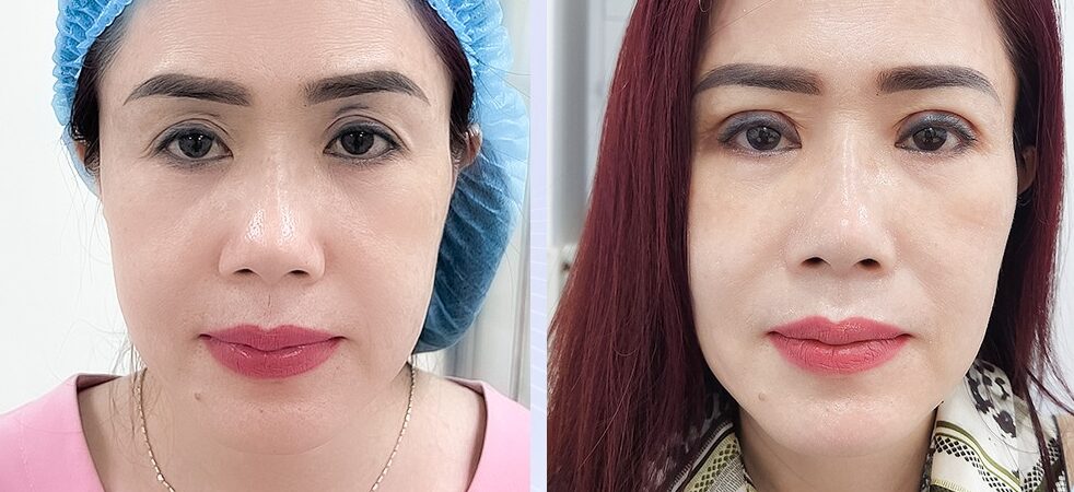 Mắt bồ câu là gì? Có ý nghĩa gì trong nhân tướng học 6 cat mi mini seouleyes e1758879022461