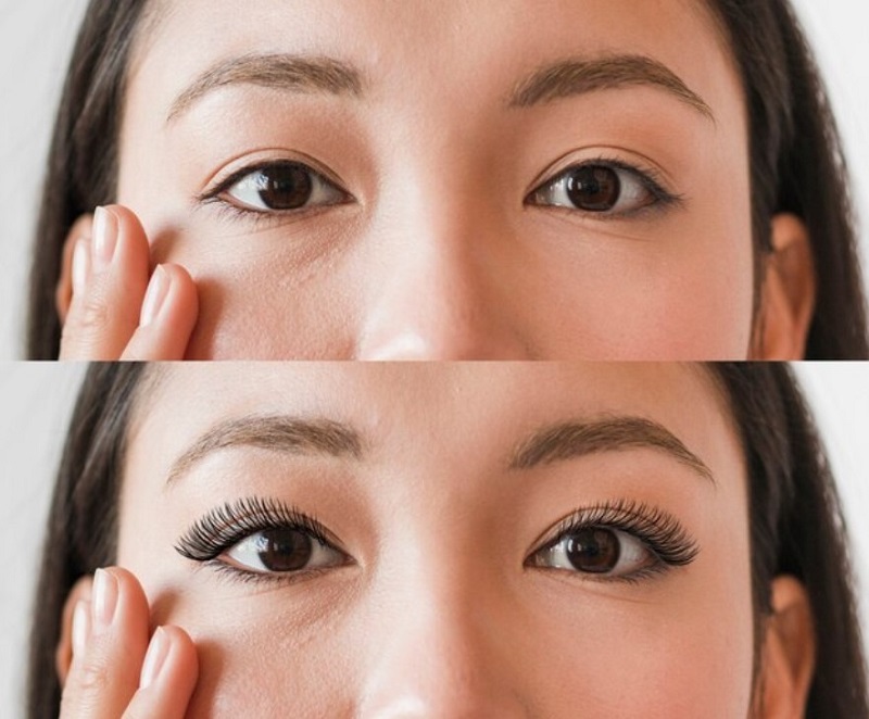 Sau khi cắt mí có được ăn đậu phụ không? Sau khi cắt mí có được ăn đậu phụ không?