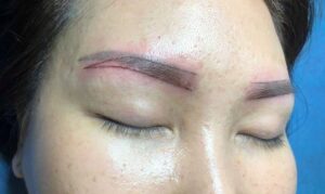 Phun xăm bị trổ xanh/đỏ/tím – Nguyên nhân và cách xử lý hiệu quả