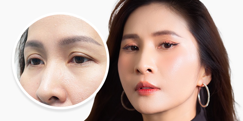 Lông mày cụp xuống là gì? Ý nghĩa tướng số ở nam và nữ 1 chan may cup xuong nen nang cung may