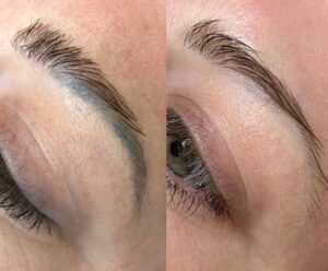 Hút dung dịch chân mày môi