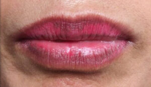 Phun môi không đều màu