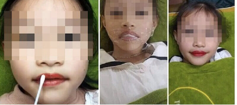 Còn trẻ xăm môi có nên không? 20 tuổi nên phun môi không? 3 con tre co nen xam 2 662a2b1d37fa7 e1757738399189