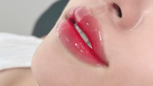 con tre co nen xam 3 662a2b1e1ac4b e1757738460902