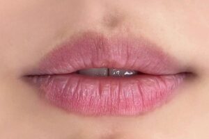 cong nghe phun moi lac hau la nguyen nhan chinh gay ra phun moi bi nhat long moi