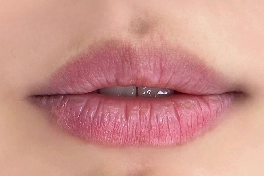 cong nghe phun moi lac hau la nguyen nhan chinh gay ra phun moi bi nhat long moi