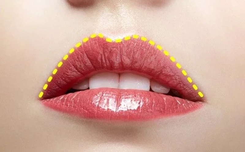 Nguyên nhân phun môi trên đậm hơn môi dưới và cách xử lý 1 phun môi trên đậm hơn môi dưới