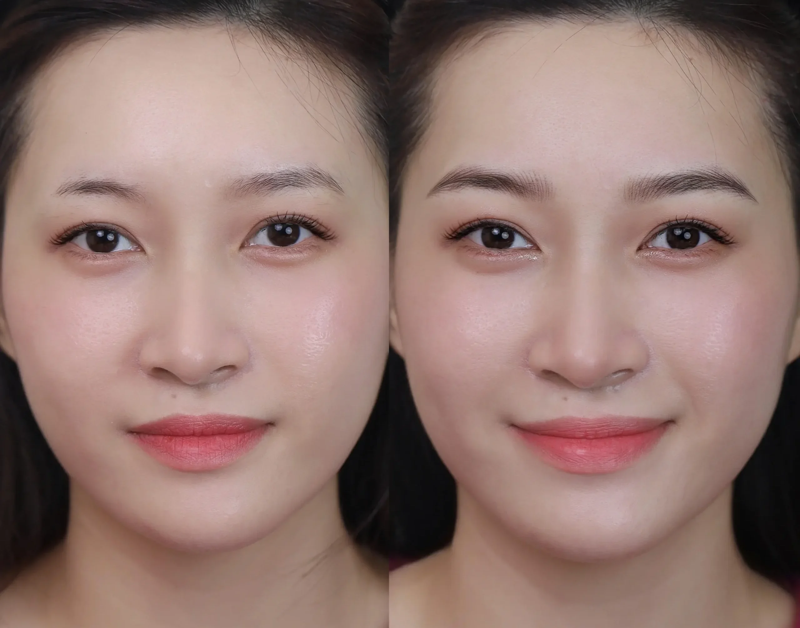 Phun xăm bị sưng lâu ngày – Nguyên nhân & cách xử lý nhanh 10 Điêu khắc Hairstroke chân mày nữ là gì?