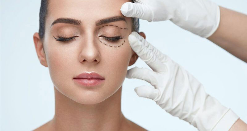 Chỉnh cơ mí mắt 6 dr eye dni lmc chinh co mi mat 6 e1758708211772