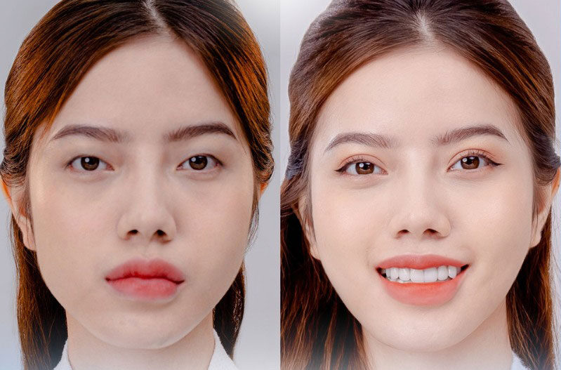 Mắt một bên 2 mí một bên 1 mí là do đâu? Cách khắc phục hiệu quả 8 dr eye ni nhan mi 14 e1758702676581