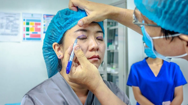 Nhấn mí mắt 7 dr eye ni nhan mi 8 e1758702507259