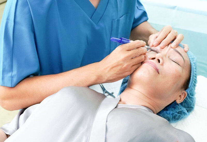 Phẫu thuật điều trị trễ mi dưới 8 dr eye phau thuat dieu tri tre mi duoi 16 e1758707789987
