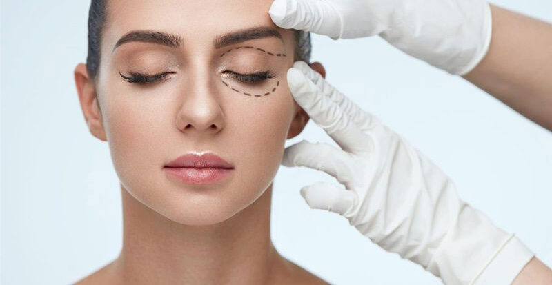 Tạo hình mí mắt trên 10 dr eye ub tao hinh mi mat tren 12 e1758707123517