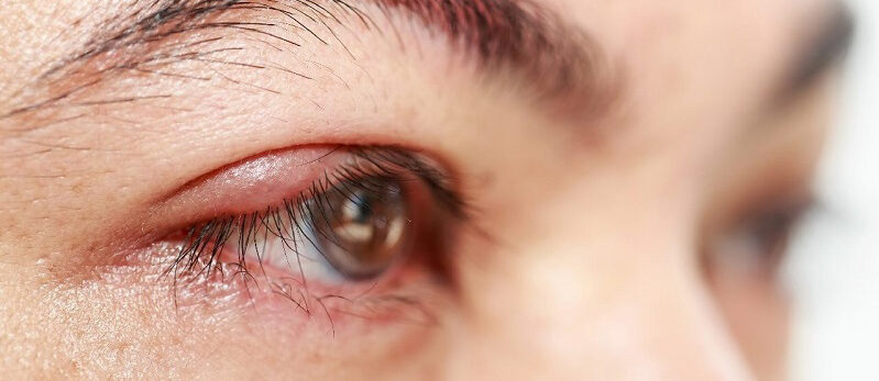 Xử lý vết thương phần mềm nông vùng mi mắt 1 dr eye xu ly vet thuong phan mem nong vung mi mat 1 e1758708946162