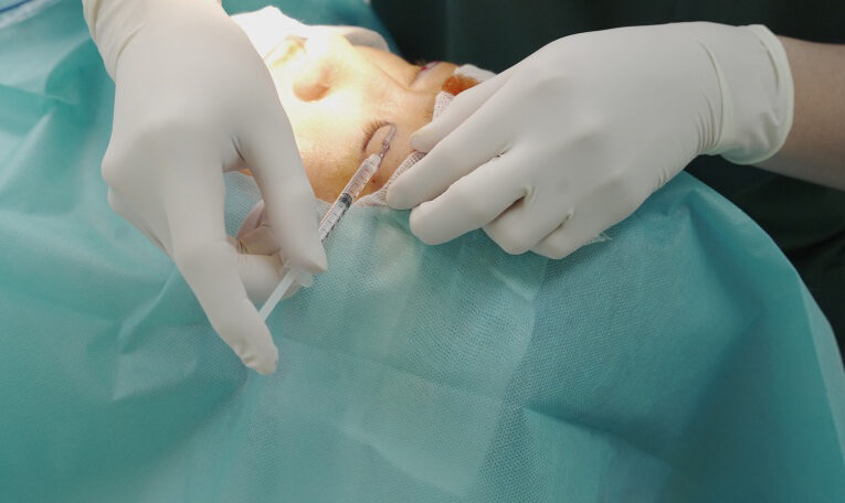 Xử lý vết thương phần mềm nông vùng mi mắt 4 dr eye xu ly vet thuong phan mem nong vung mi mat 5 e1758708922358