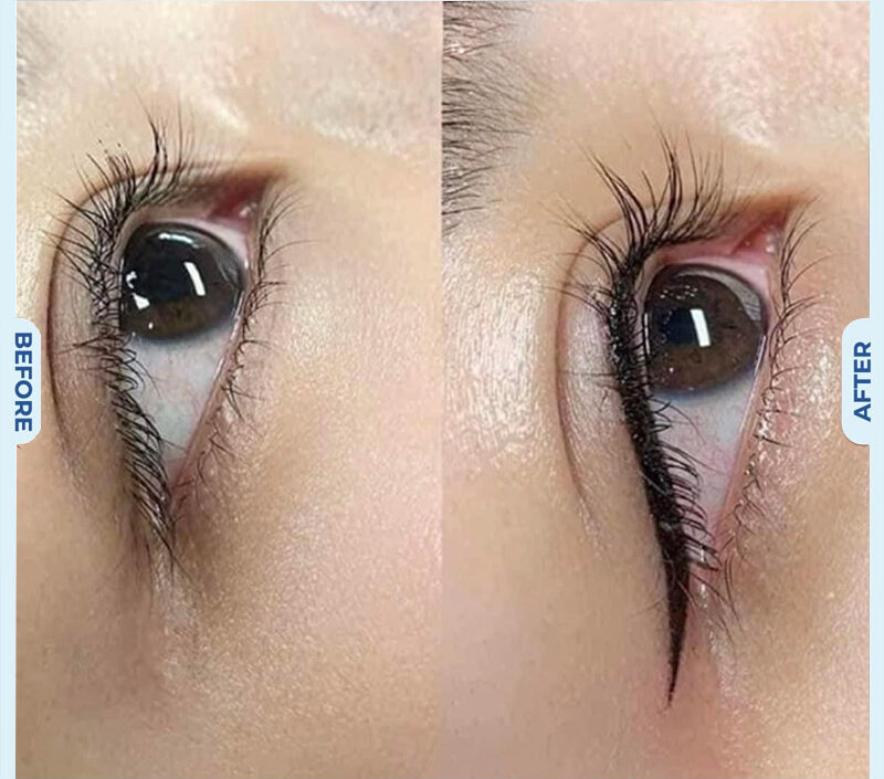 Tạo hình mi mắt 8 dr eyelid 10 e1758854875609