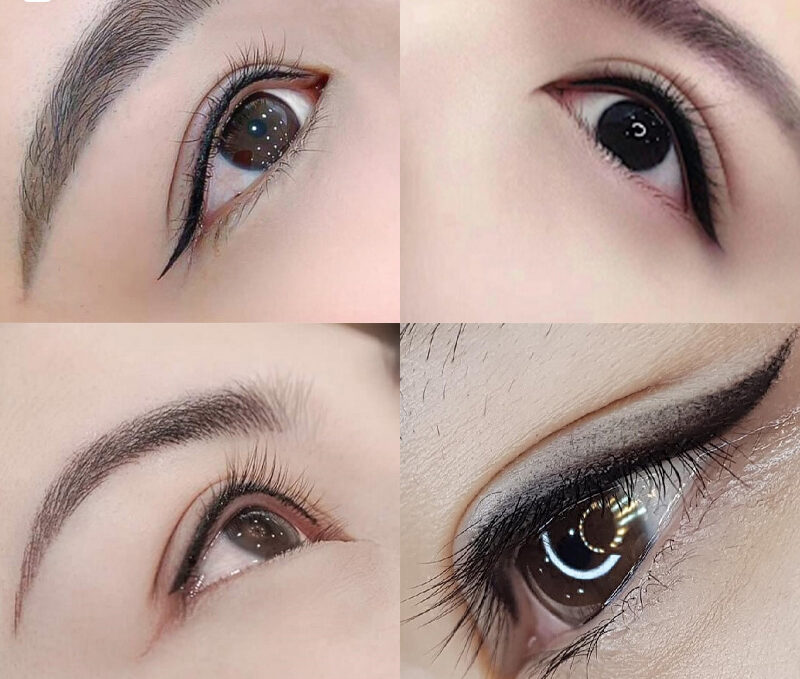 Tạo hình mi mắt 3 dr eyelid 2 e1758854495312