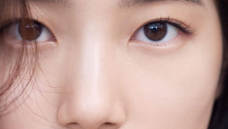 Tạo hình mi mắt 4 dr eyelid 3 e1758854560452