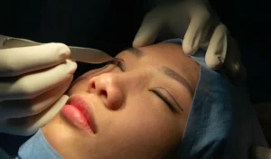 giai dap thac mac nhung thong tin ve nhan mi mat bang chi 1 029755285c