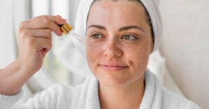 tế bào gốc trị nám