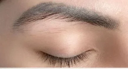 hinh anh sau khi xoa xam long may e1764136453586