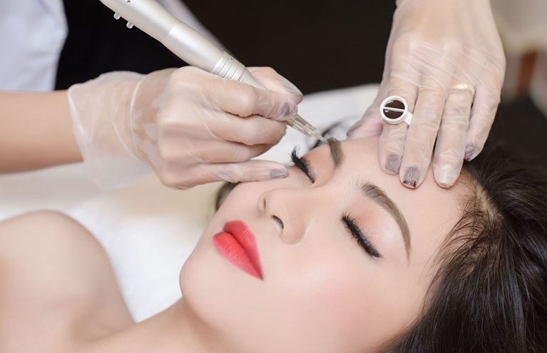 Chân Mày Trổ Xanh Là Gì? Nguyên Nhân, Cách Xử Lý 3 Kỹ thuật đi kim quá sâu