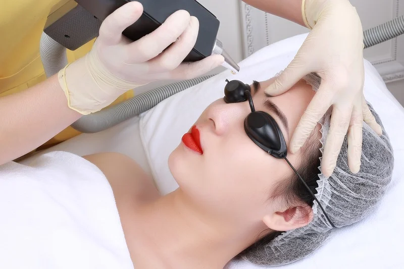 Xóa xăm mày xong bị trổ xanh lá có sao không Xóa xăm mày xong bị trổ xanh lá có sao không