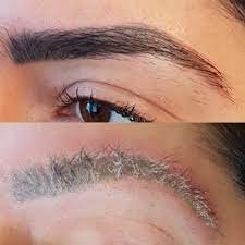Biểu hiện sau khi xóa xăm chân mày: Những điều bạn cần biết để yên tâm làm đẹp 1 images 3 3