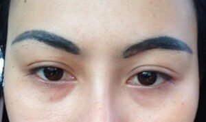 Các lỗi thường gặp sau phun xăm và cách khắc phục hiệu quả