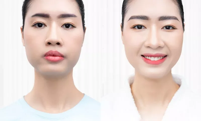 Lông mày rồng là gì? Nam, nữ có tướng mày rồng sướng hay khổ? 10 long may rong 10 e1758976849656