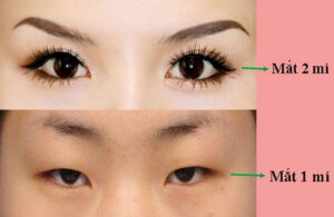 Phân biệt đôi mắt 1 mí và 2 mí