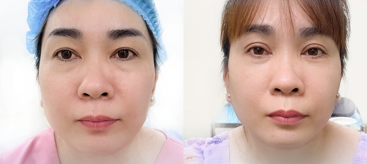 Mắt bồ câu là gì? Có ý nghĩa gì trong nhân tướng học 7 mat bo cau 6 e1758879087159