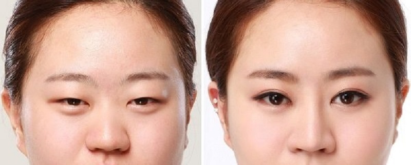 Bí quyết làm đẹp sau sinh an toàn cho mẹ bỉm 8 mat buon 9