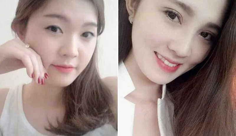 Mắt lươn là gì? Tướng số tốt hay xấu ở nam và nữ 5 mat luon 4 e1758862715853