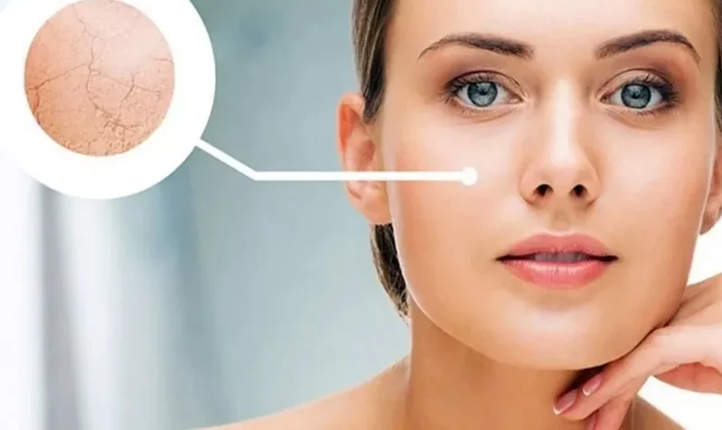 Hốc mắt sâu là do đâu? Cách khắc phục mắt sâu hiệu quả 3 mat sau 3 e1758861687654