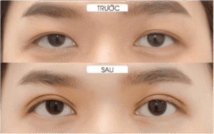 Mắt tứ bạch là gì? Ý nghĩa về tướng số của tứ bạch nhãn