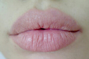 môi bị nhăn sau khi phun xăm