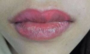 Môi sau phun xăm bị loang màu: Vì sao và làm sao xử lý (2026) 1 Môi sau phun xăm bị loang màu: Vì sao và làm sao xử lý