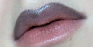 môi trên thâm môi dưới hồng